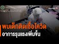 อาการ