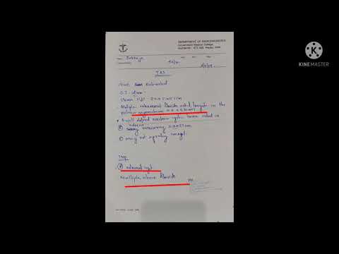 Uterine fibroids