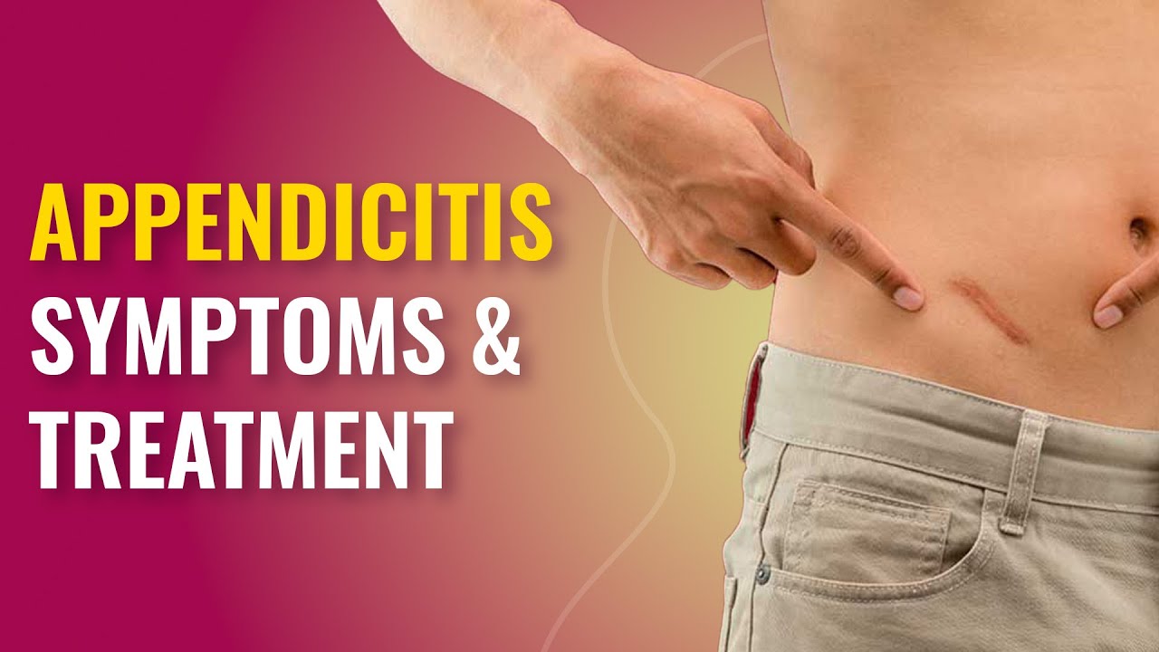 What is Appendicitis and How to Recognize Its Symptoms?, Beauty Vigour
