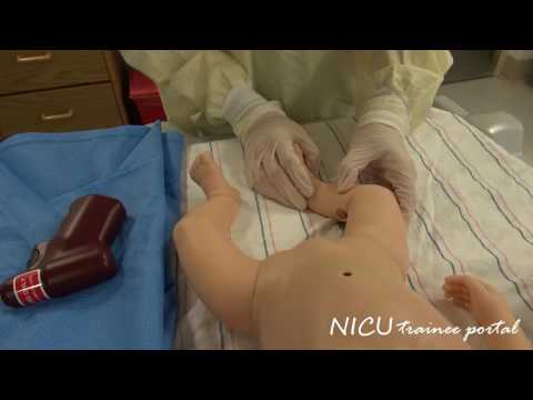 NICU Procedures: Intraosseous Catheter Access