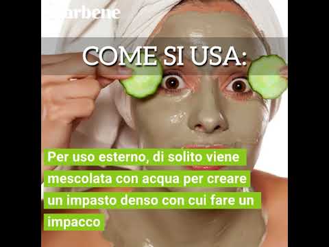Shunya e lentiggine Leliminazione di pigmentary nota su una faccia in Kazan