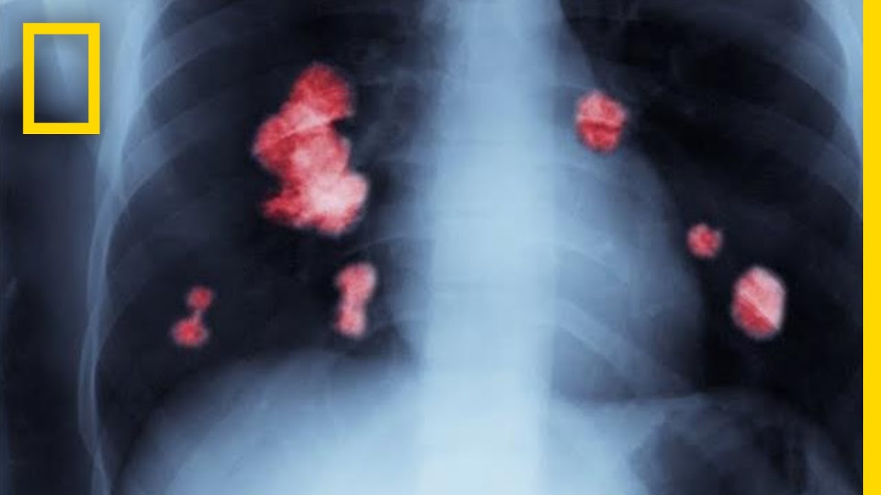 Relying on the Kind of Surgical Procedure