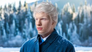 He's The World's Most Famous Albino
