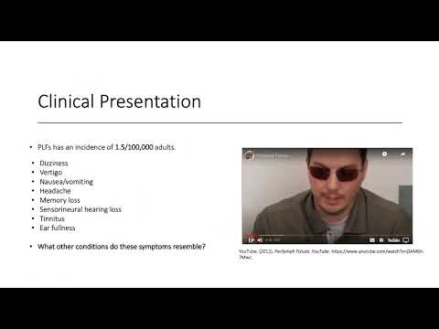 Perilymphatic Fistula Presentation