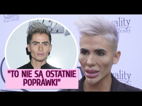 Polski "Żywy Ken" planuje kolejne operacje plastyczne: "Efekt jest ZBYT NATURALNY"