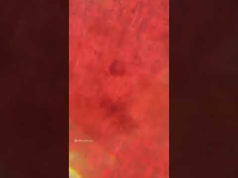 Human cell under microscope😯 || under microscope video 😮