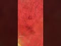 Human Cell Under Microscope Under Microscope Video
