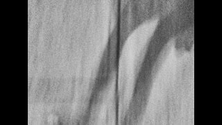 Erotonin - Klinefelter