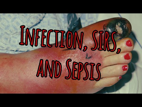 , title : 'Recycled Prolonged Fieldcare Podcast 19: Infection, SIRS, and Sepsis'