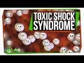 Toxic Shock Syndrome: Way Beyond Tampons