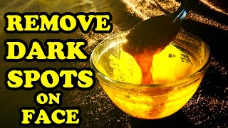 HOME REMEDIES FOR DARK SPOTS ON FACE, NATURAL REMEDIES TO REMOVE DARK SPOTS NATURALLY, DIY FACE MASK