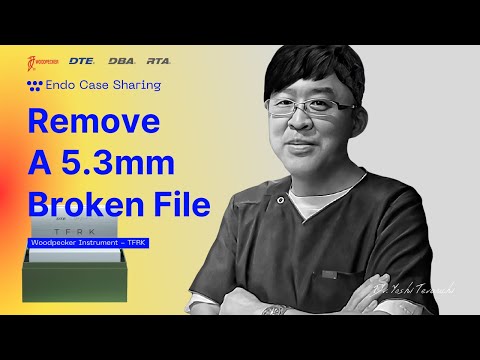 【Case Sharing】-Remove A 5.3mm Broken File (by Dr. Yoshi Terauchi) - TFRK