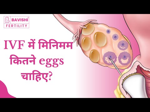 How Many Eggs Are Needed for IVF? — Dr. Parth Bavishi