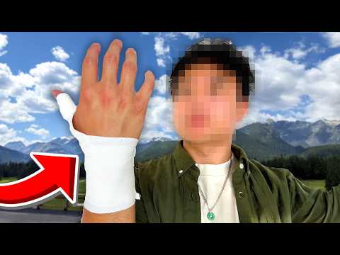 my hand is broken... again