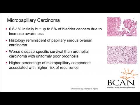 gége papilloma hisztopathology hogyan lehet megszabadulni a nemi szemölcsöktől fórum