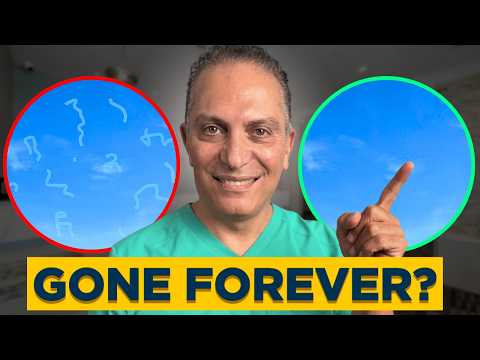 How to get rid of Eye Floaters? | EYE DOCTOR ADVICE