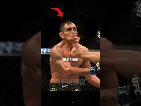 FERGUSON'S FACE AFTER THE FRONT-KICK!