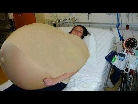 Ärzte untersuchten ihren Bauch, dabei erlebten sie eine riesige Überraschung!