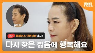 50대 풀페이스 안면거상 4개월차 얼굴을 쫘~악 당긴 놀라운 변신