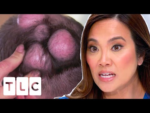 Dr. Sandra Lee Sees Patient With EIGHT BUMPS On His Head | Dr. Pimple Popper