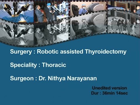 Robotic Assisted Thyroidectomy - Dr Nithya Narayanan - Unedited Version