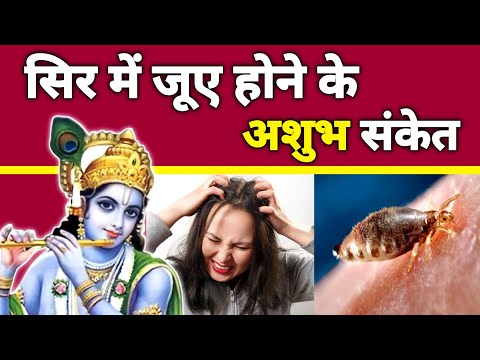 सर में जू आना संकेत ! क्या कहते है श्री कृष्ण ? sir mein ju hona shubh hai ya ashubh