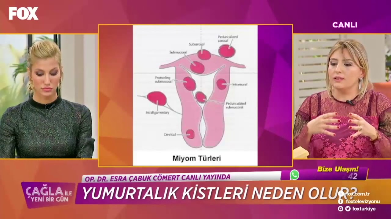 Esra Çabuk Cömert-28