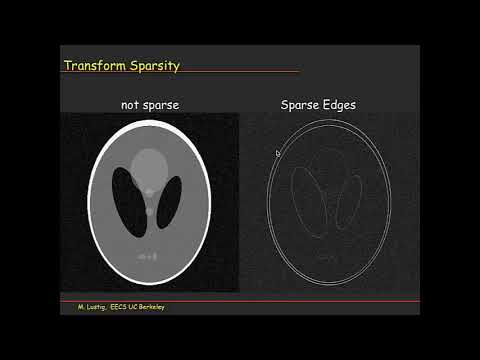 ISMRM MR Academy - Compressed Sensing in MRI