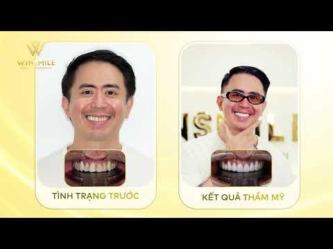 Khách hàng ngoại quốc trải nghiệm thẩm mỹ răng sứ và kết quả ngoài mong đợi| Nha khoa Win Smile