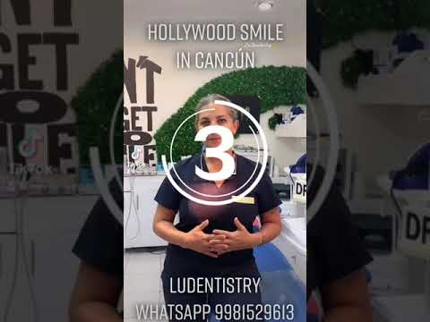 Hollywood Smiles in Cancun with Zirconium Crowns