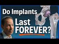 Will My Hip or Knee Implant Last a LIFETIME? Explained Step-by-Step