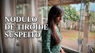 NÓDULO NA TIREOIDE SUSPEITO: O Que Aconteceu Comigo. (Parte 1)