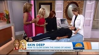 Ultherapy on The TODAY Show