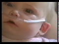 WHO Oxygen Therapy For Children III