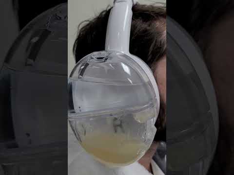 Have you ever experience itchy or painful ears? Removing earwax buildup can alleviate those symptoms