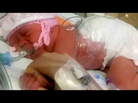 Les médecins lui ont dit 10 fois d'arrêter sa grossesse mais elle ne les a pas écoutées. Video