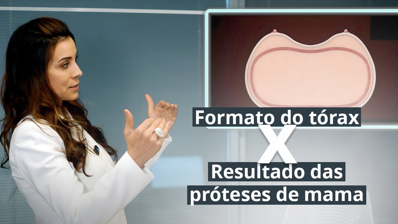 PRÓTESES DE MAMA: O formato do seu tórax pode mudar completamente o resultado!