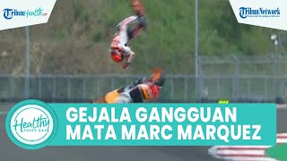 Apa itu Diplopia? Ini Gejala Gangguan pada Pandangan Mata Berbayang yang Diidap Marc Marquez