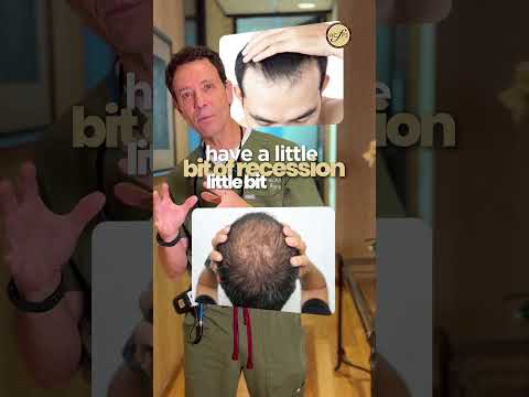 FUE Hair Transplant Results: What to Expect | Dr. Bradford Patt Explains NeoGraft Timeline & Outcome