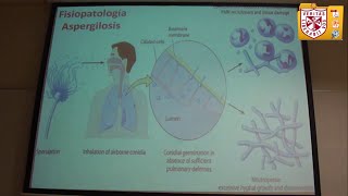 preview picture of video 'Microbiología   Micosis Sistémicas'