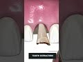Tooth Implant Procedure STEP BY STEP