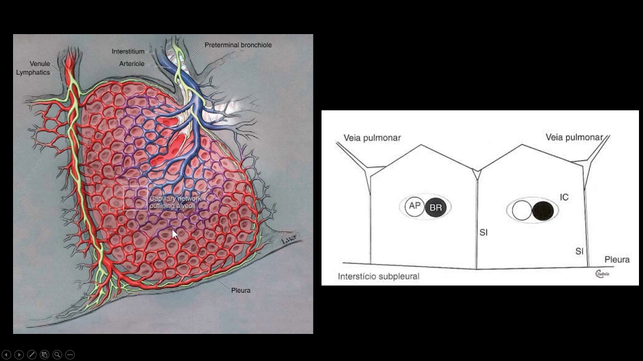 Doenças pulmonares intersticiais (vídeo 1)