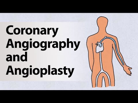 Coronary Angiography and Angioplasty