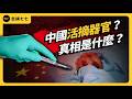實習醫生墜樓，竟和器官移植黑幕有關？中國器官移植制度，有哪些疑點？他們真的會活摘器官嗎？｜志祺七七
