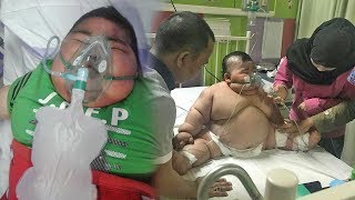 Viral Balita 4 Tahun di Kalsel Sakit Komplikasi karena Obesitas, Dirawat di RS dan Butuh Bantuan