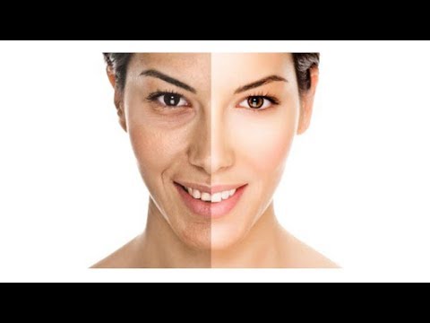 Lentiggini marroni di una fotografia I cosmetici coreani che candeggiano pigmentary posti