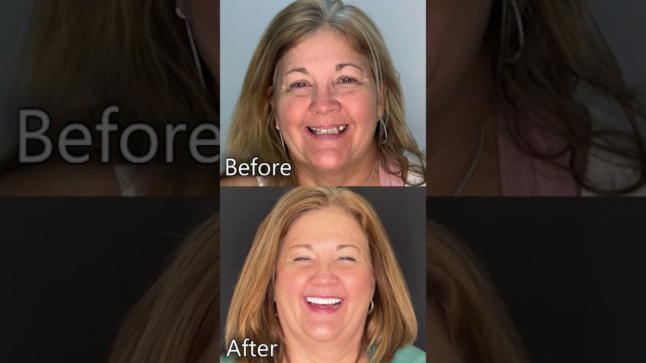 Jacqueline's Testimonial