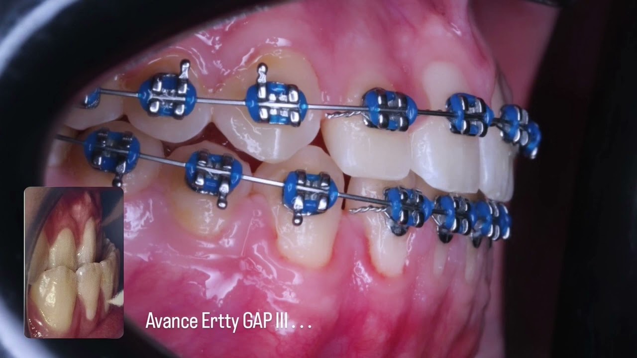 José Luis Pérez Vázquez-6