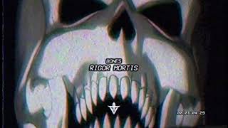 Bones - RigorMortis