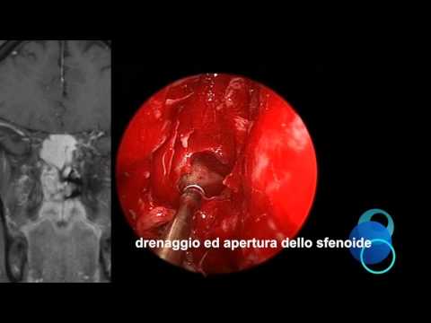 Mal di schiena per 4 mesi di gravidanza Ginocchio dolorante durante la deambulazione e raddrizzare le gambe nellarticolazione del ginocchio